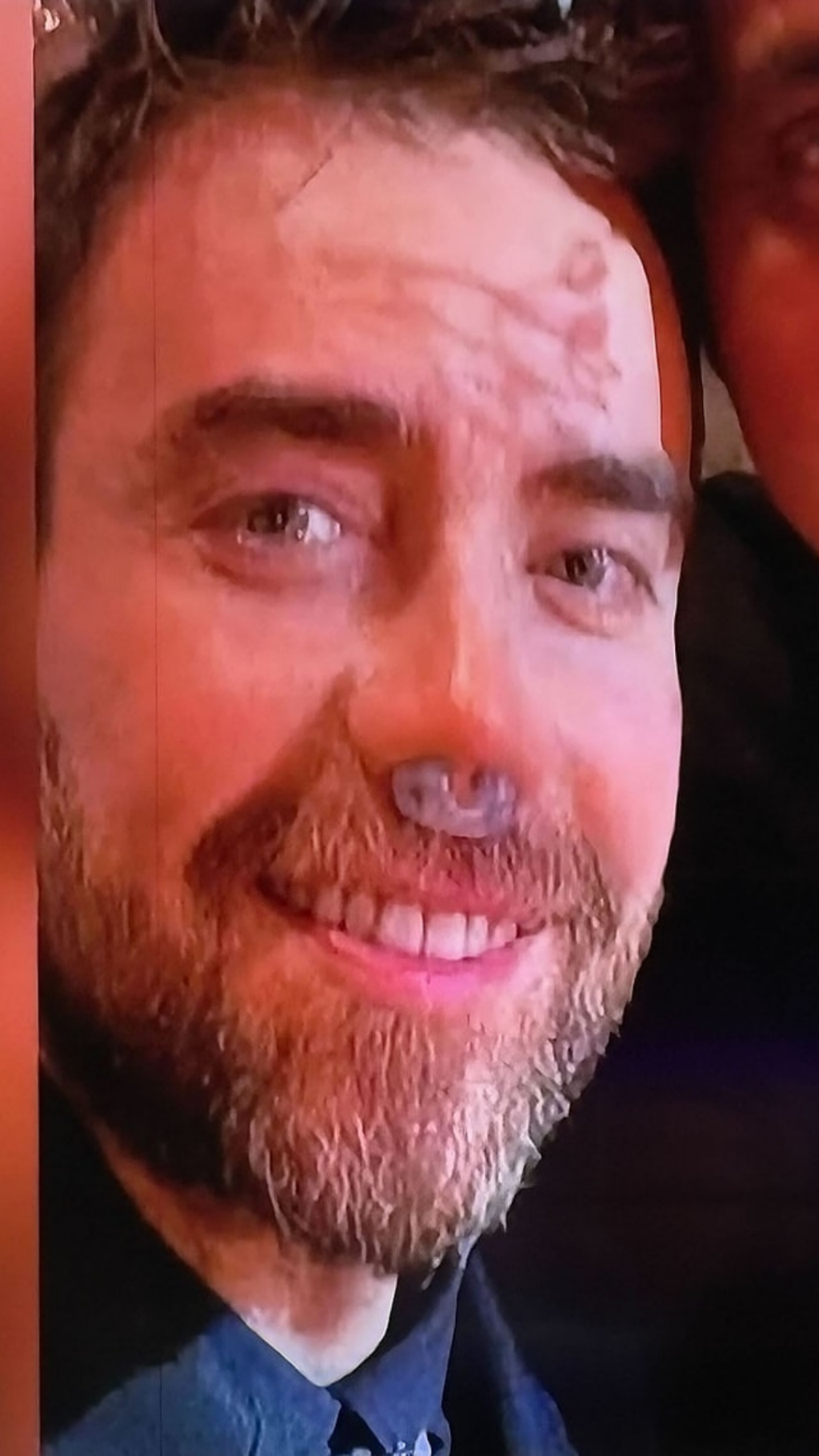Murat Dalkılıç son hali